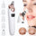 Electric Blackhead Remover | Vacuum Acne & Pore Cleaner | 5 Heads Suction Machine | Skin Care & Exfoliating Tool