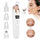 Electric Blackhead Remover | Vacuum Acne & Pore Cleaner | 5 Heads Suction Machine | Skin Care & Exfoliating Tool